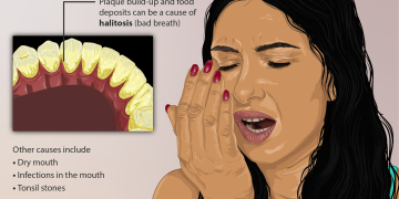 How to deal with Halitosis?