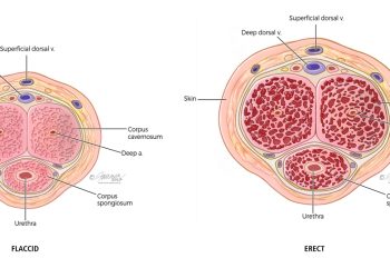 The profound association between the issue of ED and hypertension