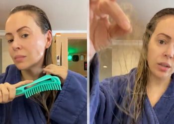 how long does covid hair loss last